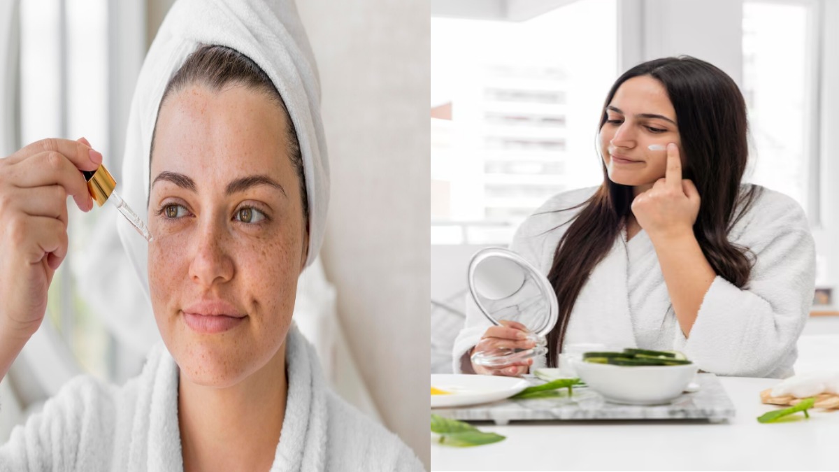 Natural Cure for Acne at Home: Simple Remedies and Skincare Tips for Clear, Healthy Skin