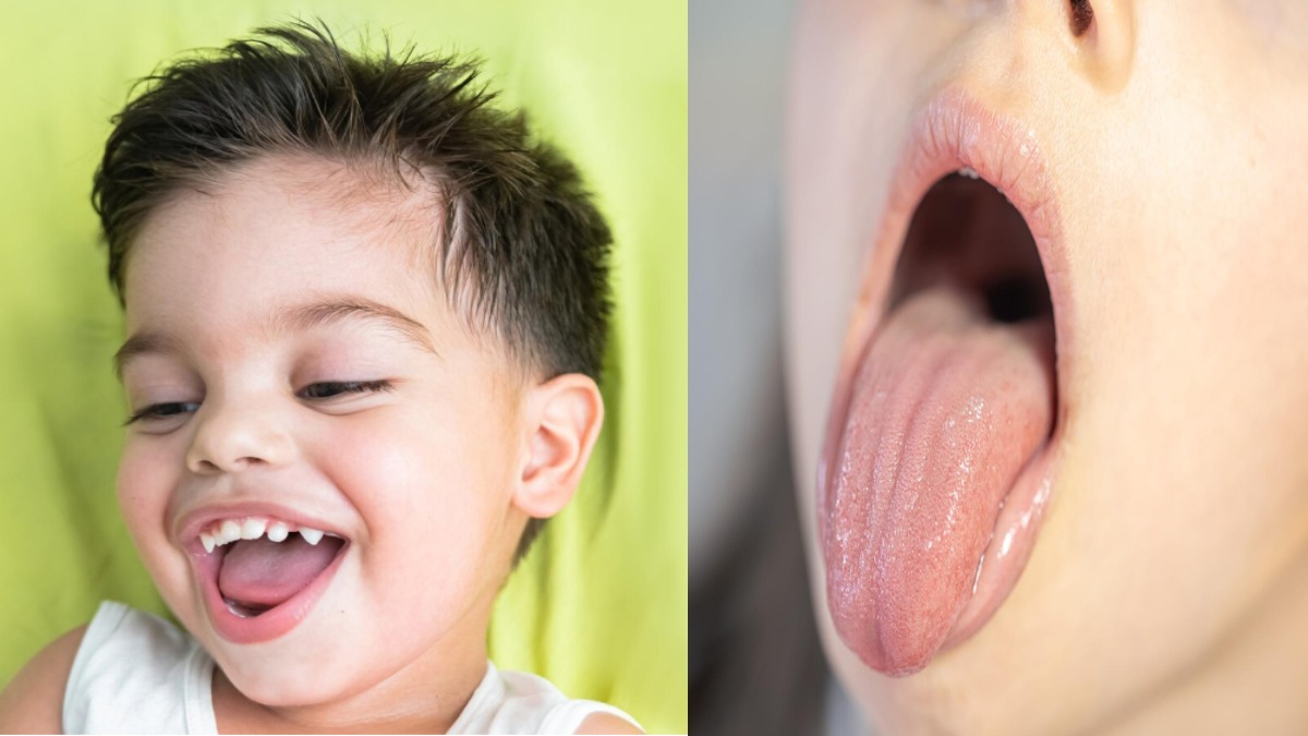 What Your Tongue Says About Your Health: Orthodontist Dr. Jaineel Parekh Explains 5 Changes That Deserve Attention