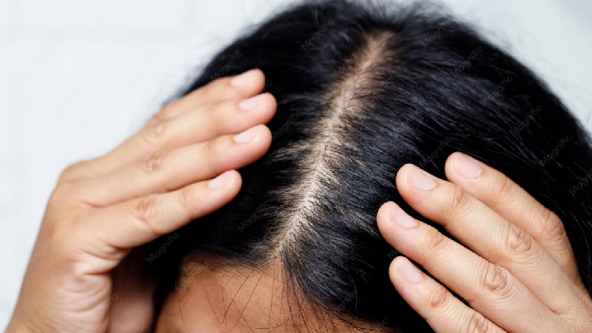 The Scalp Care