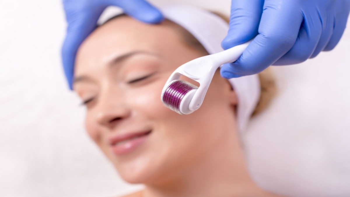 What Is Dermarolling and Is It Good for Your Skin? Benefits, Risks and How to Use It Safely