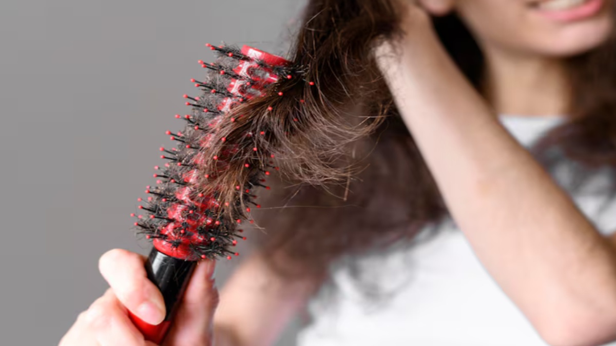 Excessive Hair Fall Could Signal a Health Problem: Causes and Warning Signs to Know