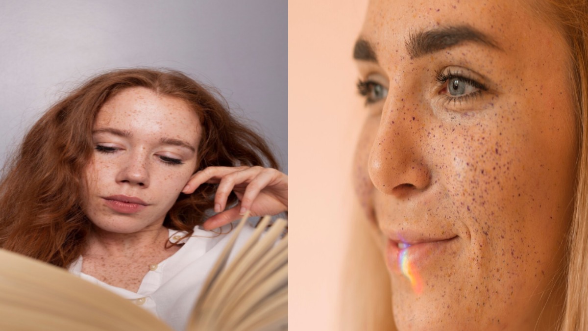 Melanin in Human Skin