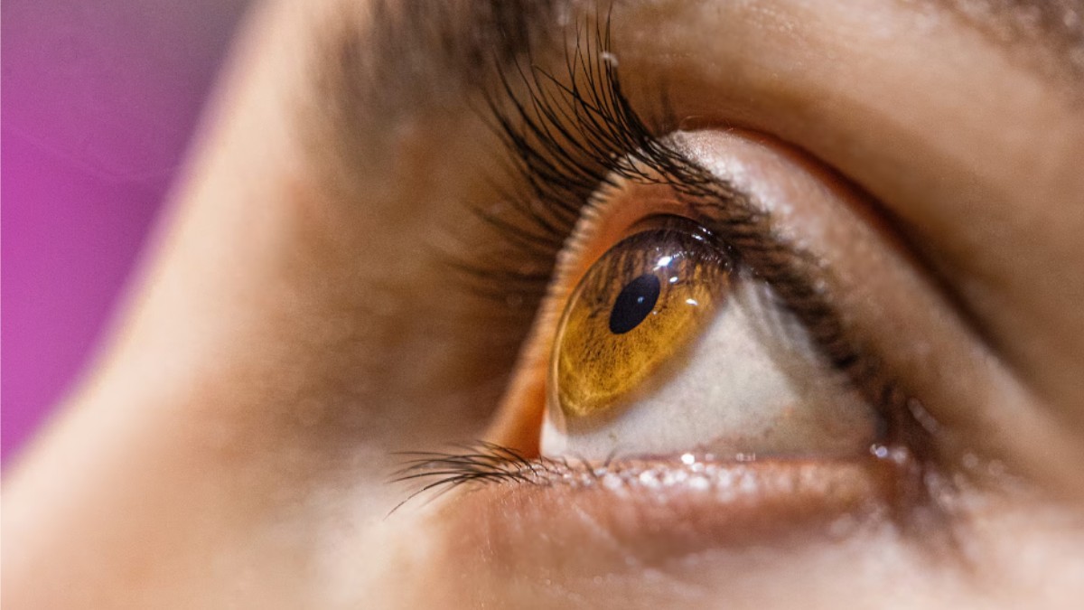 Can Your Eyes Reveal Heart Disease Risk? Signs You Should Know