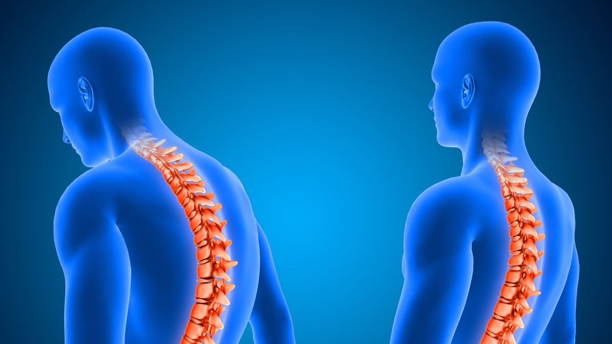 Worried About Weakening Spine? 6 Ways To Maintain Spine Health With Age