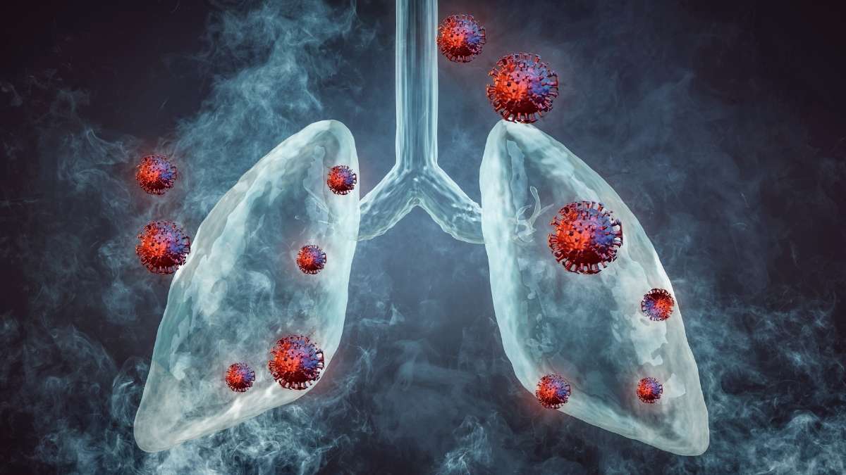 World Lung Cancer Day 2026: Why More Young Adults, Women and Non-Smokers Are Being Diagnosed