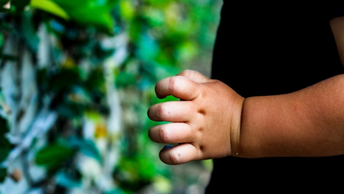 400 Million Children Aged 5-19 Are Overweight: 7 Things Parents Can Do