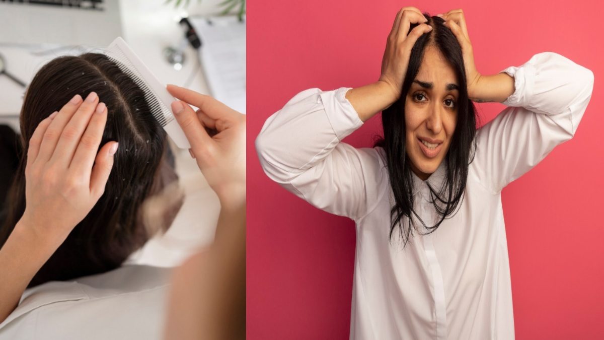 Dr. Praneeta Jain Explains How an 18-Year-Old’s Severe Dandruff Case Highlights a Common Mistake with Colour-Treated Hair